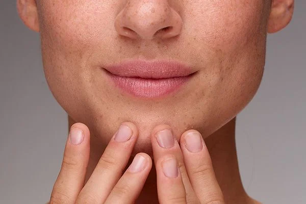 Best Dermatologist in Quetta