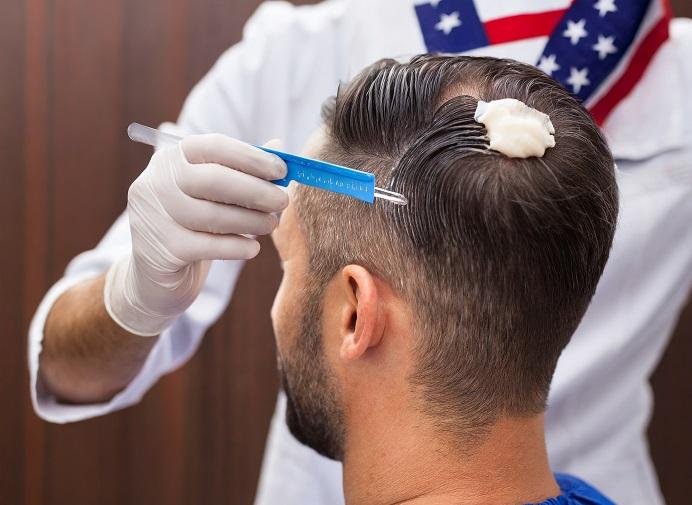 Does hair transplant last forever